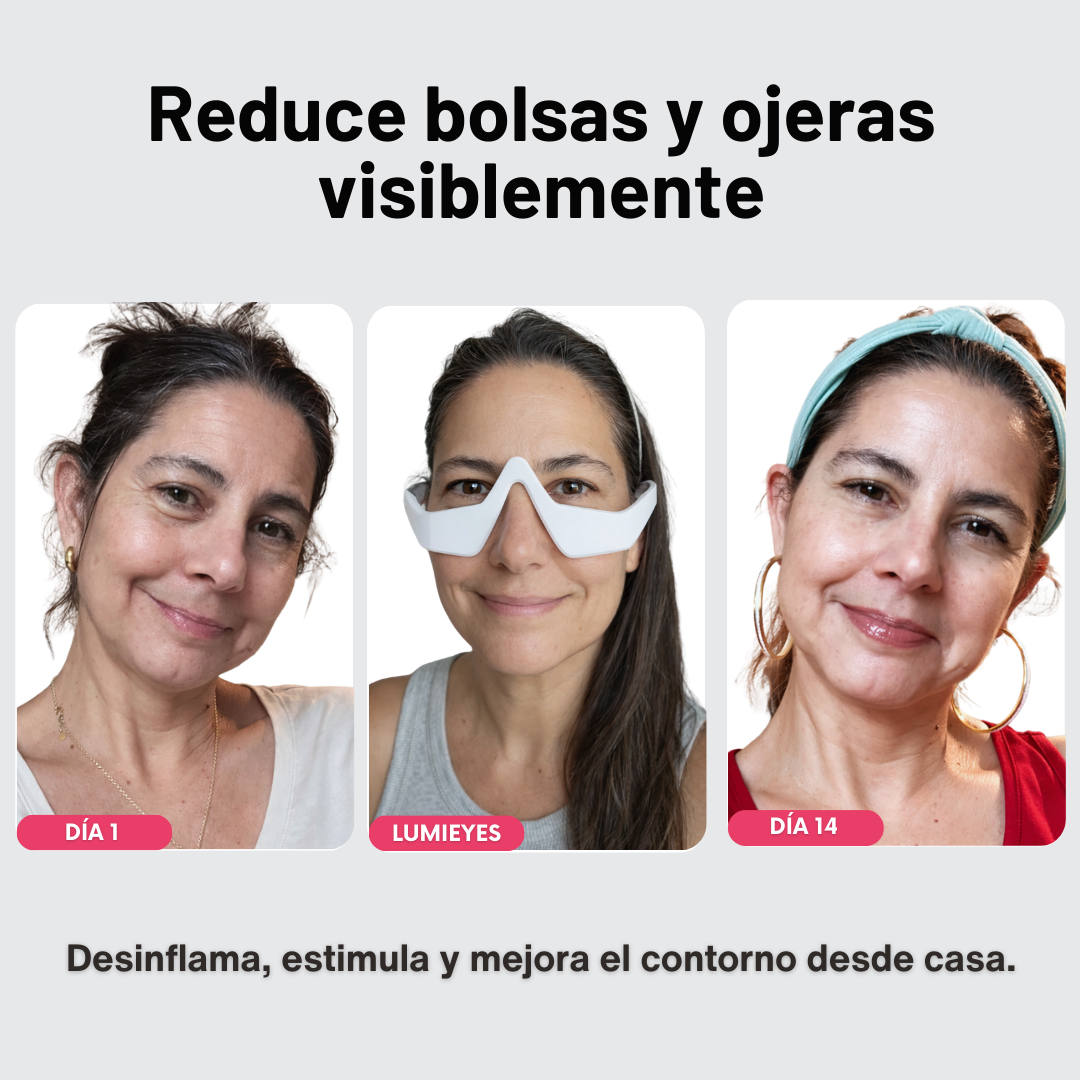 Adiós bolsas & ojeras. Más luz en tu mirada.